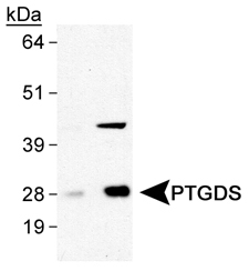 Prostaglandin D Synthase Antibody - Detection of PTGDS in human brain lysates using antibody at 0.5 and 2.0 ug/ml.  This image was taken for the unconjugated form of this product. Other forms have not been tested.