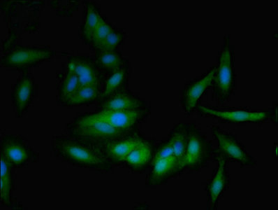 Prostaglandin D Synthase Antibody - Immunofluorescent analysis of Hela cells using PTGDS Antibody at dilution of 1:100 and Alexa Fluor 488-congugated AffiniPure Goat Anti-Rabbit IgG(H+L)