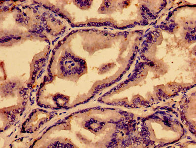 Prostaglandin D Synthase Antibody - Immunohistochemistry of paraffin-embedded human prostate tissue using PTGDS Antibody at dilution of 1:100