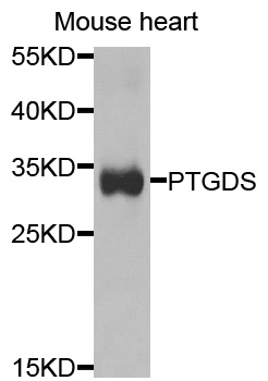 Prostaglandin D Synthase Antibody - Western blot analysis of extracts of mouse liver cells.
