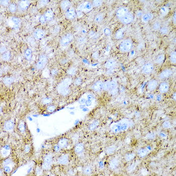 Prostaglandin D Synthase Antibody - Immunohistochemistry of paraffin-embedded rat brain tissue.
