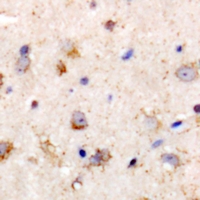 Prostaglandin D Synthase Antibody - Immunohistochemical analysis of PGD2 synthase staining in rat brain formalin fixed paraffin embedded tissue section. The section was pre-treated using heat mediated antigen retrieval with sodium citrate buffer (pH 6.0). The section was then incubated with the antibody at room temperature and detected using an HRP conjugated compact polymer system. DAB was used as the chromogen. The section was then counterstained with hematoxylin and mounted with DPX.