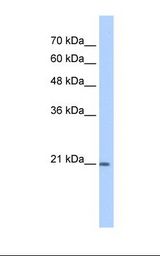 Prostaglandin D Synthase Antibody - HepG2 cell lysate. Antibody concentration: 1.0 ug/ml. Gel concentration: 12%.  This image was taken for the unconjugated form of this product. Other forms have not been tested.