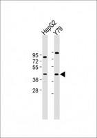 Prostaglandin D2 Receptor Antibody - All lanes: Anti-PTGDR Antibody (C-Term) at 1:2000 dilution Lane 1: HepG2 whole cell lysate Lane 2: Y79 whole cell lysate Lysates/proteins at 20 µg per lane. Secondary Goat Anti-Rabbit IgG, (H+L), Peroxidase conjugated at 1/10000 dilution. Predicted band size: 40 kDa Blocking/Dilution buffer: 5% NFDM/TBST.