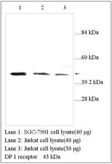 Prostaglandin D2 Receptor Antibody
