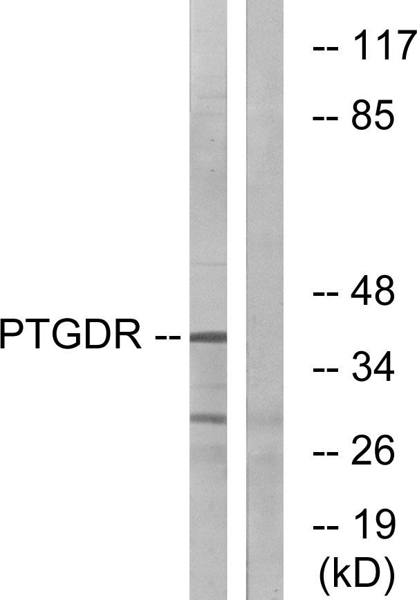 Prostaglandin D2 Receptor Antibody - Western blot analysis of extracts from HepG2 cells, using PTGDR antibody.