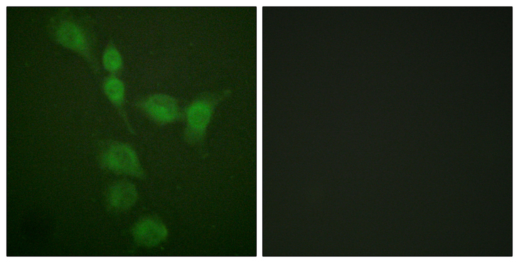 Protein Kinase A (PKA) Catalytic Subunit Antibody - Immunofluorescence analysis of A549 cells, using PKA alpha/beta CAT Antibody. The picture on the right is blocked with the synthesized peptide.