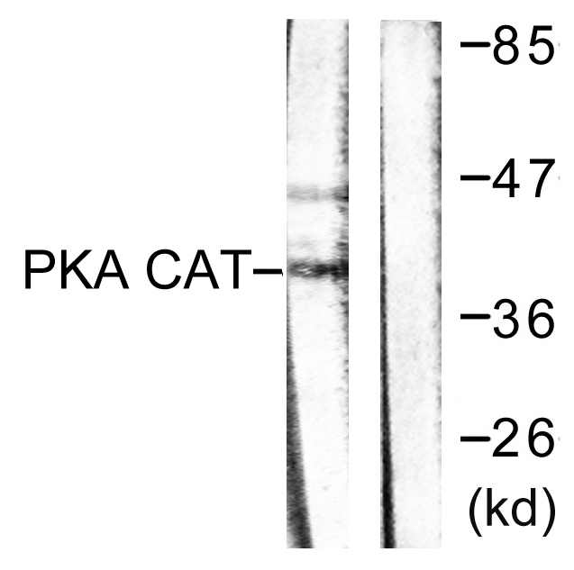 Protein Kinase A (PKA) Catalytic Subunit Antibody - Western blot analysis of lysates from mouse brain, using PKA alpha/beta CAT Antibody. The lane on the right is blocked with the synthesized peptide.