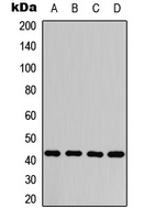 Protein Kinase A (PKA) Catalytic Subunit Antibody - Western blot analysis of PKA C alpha/beta/gamma (pT198) expression in HEK293T UV-treated (A); NIH3T3 UV-treated (B); H9C2 PMA-treated (C); PC12 H2O2-treated (D) whole cell lysates.