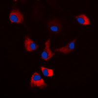 Protein Kinase A (PKA) Catalytic Subunit Antibody - Immunofluorescent analysis of PKA C alpha/beta/gamma (pT198) staining in HEK293T cells. Formalin-fixed cells were permeabilized with 0.1% Triton X-100 in TBS for 5-10 minutes and blocked with 3% BSA-PBS for 30 minutes at room temperature. Cells were probed with the primary antibody in 3% BSA-PBS and incubated overnight at 4 deg C in a humidified chamber. Cells were washed with PBST and incubated with a DyLight 594-conjugated secondary antibody (red) in PBS at room temperature in the dark. DAPI was used to stain the cell nuclei (blue).