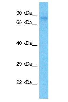 PROX1 Antibody - PROX1 antibody Western Blot of PANC1. Antibody dilution: 1 ug/ml.  This image was taken for the unconjugated form of this product. Other forms have not been tested.