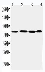 PROX1 Antibody - WB of PROX1 antibody. Lane 1: Rat Thymus Tissue Lysate. Lane 2: HELA Cell Lysate. Lane 3: JURKAT Cell Lysate. Lane 4: MM231 Cell Lysate.