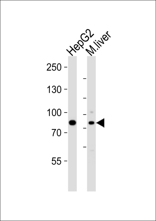 PROX1 Antibody - Western blot of lysates from HepG2 cell line and mouse liver tissue lysate(from left to right), using PROX-1 Antibody (S514). Antibody was diluted at 1:1000 at each lane. A goat anti-rabbit IgG H&L (HRP) at 1:5000 dilution was used as the secondary antibody. Lysates at 35ug per lane.