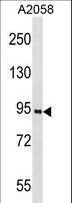 PROX1 Antibody - PROX1 Antibody (K507) western blot of A2058 cell line lysates (35 ug/lane). The PROX1 antibody detected the PROX1 protein (arrow).