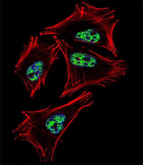 PROX1 Antibody - Fluorescent confocal image of A2058 cell stained with PROX1 Antibody. A2058 cells were fixed with 4% PFA (20 min), permeabilized with Triton X-100 (0.1%, 10 min), then incubated with PROX1 primary antibody (1:25, 1 h at 37°C). For secondary antibody, Alexa Fluor 488 conjugated donkey anti-rabbit antibody (green) was used (1:400, 50 min at 37°C). Cytoplasmic actin was counterstained with Alexa Fluor 555 (red) conjugated Phalloidin (7units/ml, 1 h at 37°C). Nuclei were counterstained with DAPI (blue) (10 ug/ml, 10 min). PROX1 immunoreactivity is localized to Nucleus significantly.