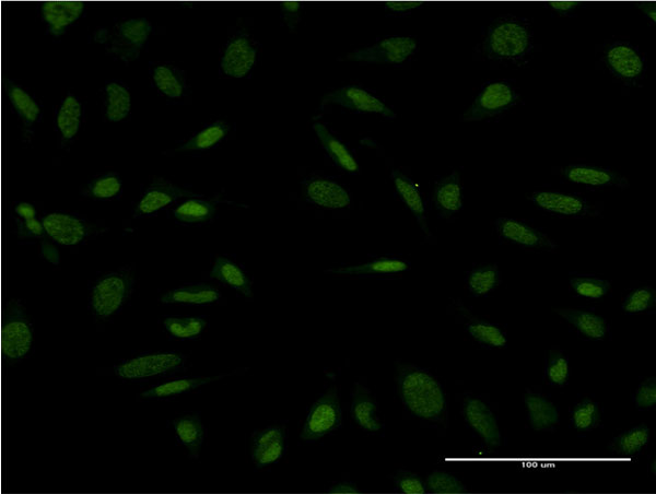 PROX1 Antibody - Immunofluorescence of monoclonal antibody to PROX1 on HeLa cell . [antibody concentration 10 ug/ml]