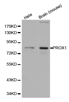 PROX1 Antibody - Western blot analysis of extracts from Hela cell and mouse brain.