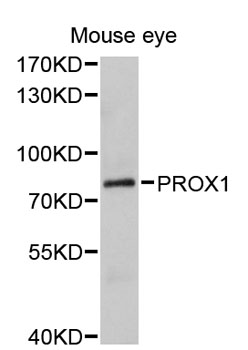 PROX1 Antibody - Western blot analysis of extracts of mouse eye, using PROX1 antibody at 1:1000 dilution. The secondary antibody used was an HRP Goat Anti-Rabbit IgG (H+L) at 1:10000 dilution. Lysates were loaded 25ug per lane and 3% nonfat dry milk in TBST was used for blocking. An ECL Kit was used for detection and the exposure time was 60s.