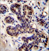 PROX2 Antibody - PROX2 Antibody immunohistochemistry of formalin-fixed and paraffin-embedded human breast tissue followed by peroxidase-conjugated secondary antibody and DAB staining.
