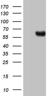 PROZ / Protein Z Antibody - HEK293T cells were transfected with the pCMV6-ENTRY control (Left lane) or pCMV6-ENTRY PROZ (Right lane) cDNA for 48 hrs and lysed. Equivalent amounts of cell lysates (5 ug per lane) were separated by SDS-PAGE and immunoblotted with anti-PROZ.