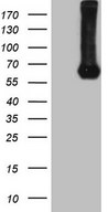PROZ / Protein Z Antibody - HEK293T cells were transfected with the pCMV6-ENTRY control. (Left lane) or pCMV6-ENTRY PROZ. (Right lane) cDNA for 48 hrs and lysed. Equivalent amounts of cell lysates. (5 ug per lane) were separated by SDS-PAGE and immunoblotted with anti-PROZ. (1:2000)