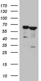 PROZ / Protein Z Antibody - HEK293T cells were transfected with the pCMV6-ENTRY control. (Left lane) or pCMV6-ENTRY PROZ. (Right lane) cDNA for 48 hrs and lysed. Equivalent amounts of cell lysates. (5 ug per lane) were separated by SDS-PAGE and immunoblotted with anti-PROZ. (1:2000)