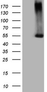 PROZ / Protein Z Antibody - HEK293T cells were transfected with the pCMV6-ENTRY control. (Left lane) or pCMV6-ENTRY PROZ. (Right lane) cDNA for 48 hrs and lysed. Equivalent amounts of cell lysates. (5 ug per lane) were separated by SDS-PAGE and immunoblotted with anti-PROZ. (1:500)