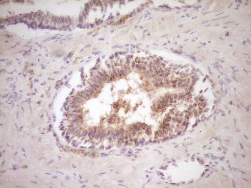 PROZ / Protein Z Antibody - Immunohistochemical staining of paraffin-embedded Human prostate tissue within the normal limits using anti-PROZ mouse monoclonal antibody. (Heat-induced epitope retrieval by 1 mM EDTA in 10mM Tris, pH8.5, 120C for 3min,