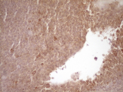 PROZ / Protein Z Antibody - Immunohistochemical staining of paraffin-embedded Human tonsil within the normal limits using anti-PROZ mouse monoclonal antibody. (Heat-induced epitope retrieval by 1 mM EDTA in 10mM Tris, pH8.5, 120C for 3min,