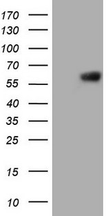 PROZ / Protein Z Antibody - HEK293T cells were transfected with the pCMV6-ENTRY control. (Left lane) or pCMV6-ENTRY PROZ. (Right lane) cDNA for 48 hrs and lysed. Equivalent amounts of cell lysates. (5 ug per lane) were separated by SDS-PAGE and immunoblotted with anti-PROZ.