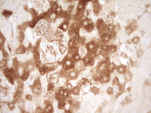 PROZ / Protein Z Antibody - Immunohistochemical staining of paraffin-embedded Human liver tissue within the normal limits using anti-PROZ mouse monoclonal antibody. (Heat-induced epitope retrieval by 1 mM EDTA in 10mM Tris, pH8.5, 120C for 3min,