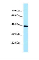 PRPF18 Antibody - Western blot of Human Placenta . PRPF18 antibody dilution 1.0 ug/ml.  This image was taken for the unconjugated form of this product. Other forms have not been tested.