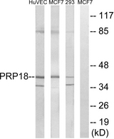 PRPF18 Antibody - Western blot analysis of lysates from 293, MCF-7, and HUVEC cells, using PRPF18 Antibody. The lane on the right is blocked with the synthesized peptide.