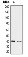 PRPF18 Antibody - Western blot analysis of PRPF18 expression in Jurkat (A); MCF7 (B) whole cell lysates.