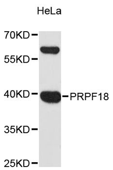 PRPF18 Antibody - Western blot analysis of extracts of HeLa cells, using PRPF18 antibody at 1:3000 dilution. The secondary antibody used was an HRP Goat Anti-Rabbit IgG (H+L) at 1:10000 dilution. Lysates were loaded 25ug per lane and 3% nonfat dry milk in TBST was used for blocking. An ECL Kit was used for detection and the exposure time was 90s.
