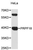 PRPF18 Antibody - Western blot analysis of extracts of HeLa cells, using PRPF18 antibody at 1:3000 dilution. The secondary antibody used was an HRP Goat Anti-Rabbit IgG (H+L) at 1:10000 dilution. Lysates were loaded 25ug per lane and 3% nonfat dry milk in TBST was used for blocking. An ECL Kit was used for detection and the exposure time was 90s.