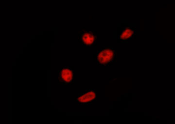 PRPF18 Antibody - Staining HepG2 cells by IF/ICC. The samples were fixed with PFA and permeabilized in 0.1% Triton X-100, then blocked in 10% serum for 45 min at 25°C. The primary antibody was diluted at 1:200 and incubated with the sample for 1 hour at 37°C. An Alexa Fluor 594 conjugated goat anti-rabbit IgG (H+L) Ab, diluted at 1/600, was used as the secondary antibody.