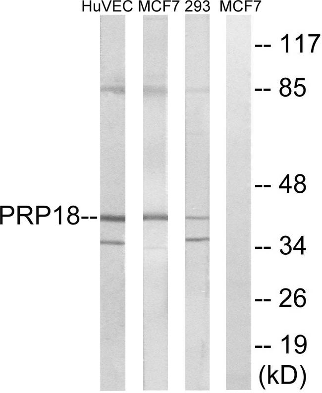 PRPF18 Antibody - Western blot analysis of extracts from HuvEc cells, MCF-7 cells and 293 cells, using PRPF18 antibody.