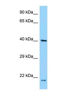PRPF18 Antibody - PRPF18 antibody Western blot of H226 Cell lysate. Antibody concentration 1 ug/ml.  This image was taken for the unconjugated form of this product. Other forms have not been tested.