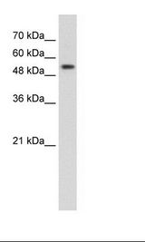 PRPF19 / PRP19 Antibody - Jurkat Cell Lysate.  This image was taken for the unconjugated form of this product. Other forms have not been tested.