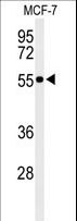 PRPF19 / PRP19 Antibody - Western blot of PRPF19 Antibody in MCF-7 cell line lysates (35 ug/lane). PRPF19 (arrow) was detected using the purified antibody.