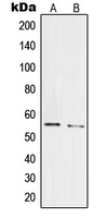 PRPF19 / PRP19 Antibody - Western blot analysis of PRPF19 expression in HepG2 (A); HeLa (B) whole cell lysates.