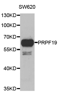 PRPF19 / PRP19 Antibody - Western blot analysis of extracts of SW620 cells.