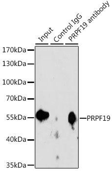 PRPF19 / PRP19 Antibody - Immunoprecipitation analysis of 200ug extracts of Jurkat cells, using 3 ug PRPF19 antibody. Western blot was performed from the immunoprecipitate using PRPF19 antibody at a dilition of 1:1000.