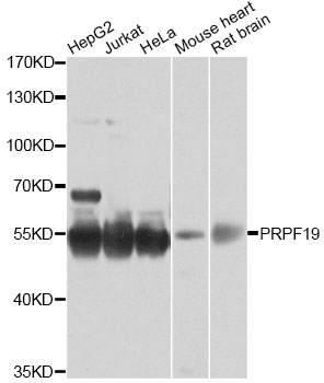 PRPF19 / PRP19 Antibody - Western blot analysis of extracts of various cell lines, using PRPF19 antibody at 1:1000 dilution. The secondary antibody used was an HRP Goat Anti-Rabbit IgG (H+L) at 1:10000 dilution. Lysates were loaded 25ug per lane and 3% nonfat dry milk in TBST was used for blocking. An ECL Kit was used for detection and the exposure time was 30s.