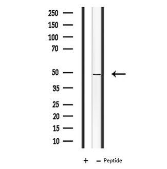 PRPF19 / PRP19 Antibody - Western blot analysis of extracts of COLO cells using PRPF19 antibody.
