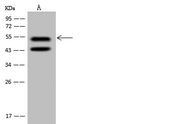 PRPF19 / PRP19 Antibody - Anti-PRPF19 rabbit polyclonal antibody at 1:500 dilution. Lane A: Jurkat Whole Cell Lysate. Lysates/proteins at 30 ug per lane. Secondary: Goat Anti-Rabbit IgG (H+L)/HRP at 1/10000 dilution. Developed using the ECL technique. Performed under reducing conditions. Predicted band size: 55 kDa. Observed band size: 55 kDa. (We are unsure as to the identity of these extra bands.)