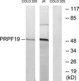 PRPF19 / PRP19 Antibody - Western blot analysis of extracts from COLO cells and Jurkat cells, using PRPF19 antibody.