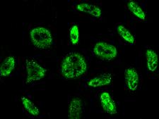 PRPF19 / PRP19 Antibody - Immunofluorescence staining of PRPF19 in HeLa cells. Cells were fixed with 4% PFA, permeabilzed with 0.3% Triton X-100 in PBS, blocked with 10% serum, and incubated with rabbit anti-Human PRPF19 polyclonal antibody (dilution ratio 1:1000) at 4°C overnight. Then cells were stained with the Alexa Fluor 488-conjugated Goat Anti-rabbit IgG secondary antibody (green). Positive staining was localized to nucleus.