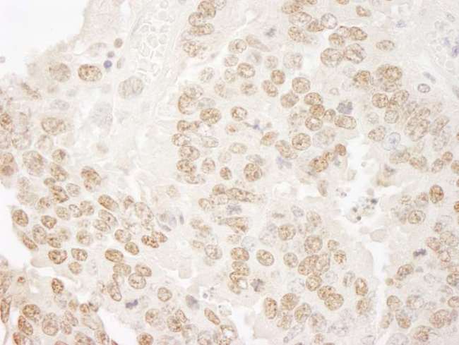 PRPF3 Antibody - Detection of Mouse hPrp3p Immunohistochemistry. Sample: FFPE section of mouse teratoma. Antibody: Affinity purified rabbit anti-hPrp3p used at a dilution of 1:100.